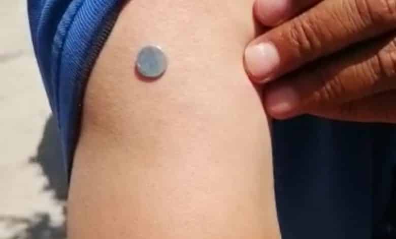 هل يؤدي لقاح كورونا إلى انجذاب المغناطيس لجسم المتلقي؟