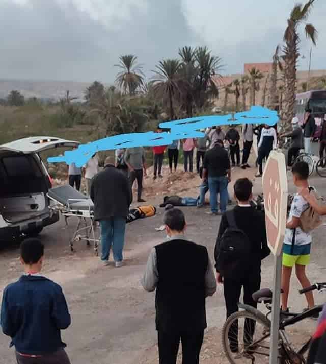 اشتوكة:سائق دراجة نارية متهور يتسبب في حادثة سير خطيرة بماسة