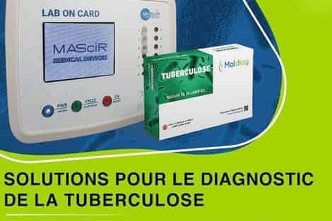 داء السل..إطلاق أول اختبار تشخيصي جزيئي مغربي 100٪