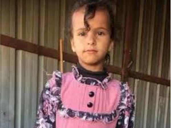 تحسن حالة الطفلة الفلسطينية المصابة الوحيدة في هجوم إيران على إسرائيل
